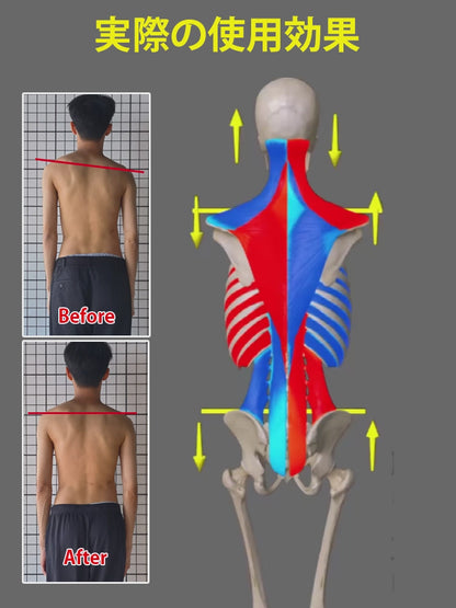 OrthoCare™ 滑り止めアウトドアビーチサンダル【男女用兼】